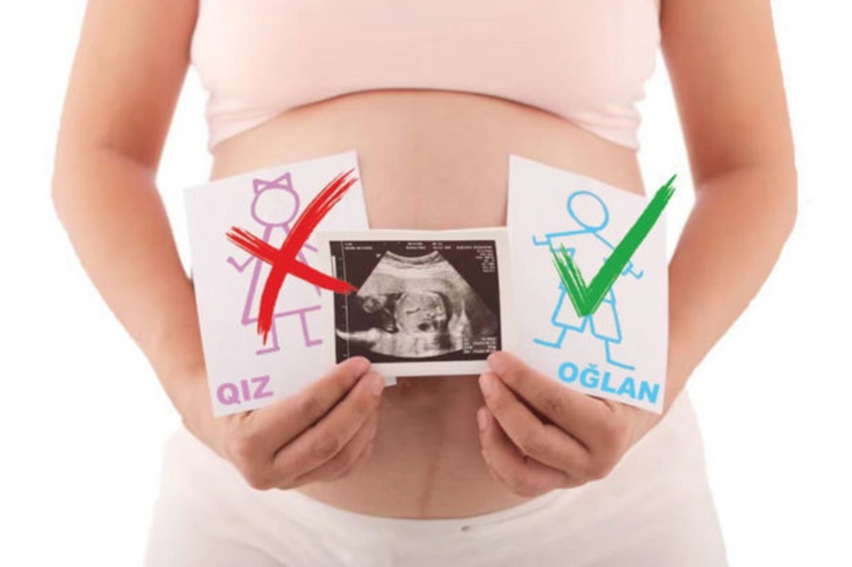 Azərbaycan selektiv aborta görə dünyada Çini də keçərək birinci yerdə qərarlaşıb - FOTO